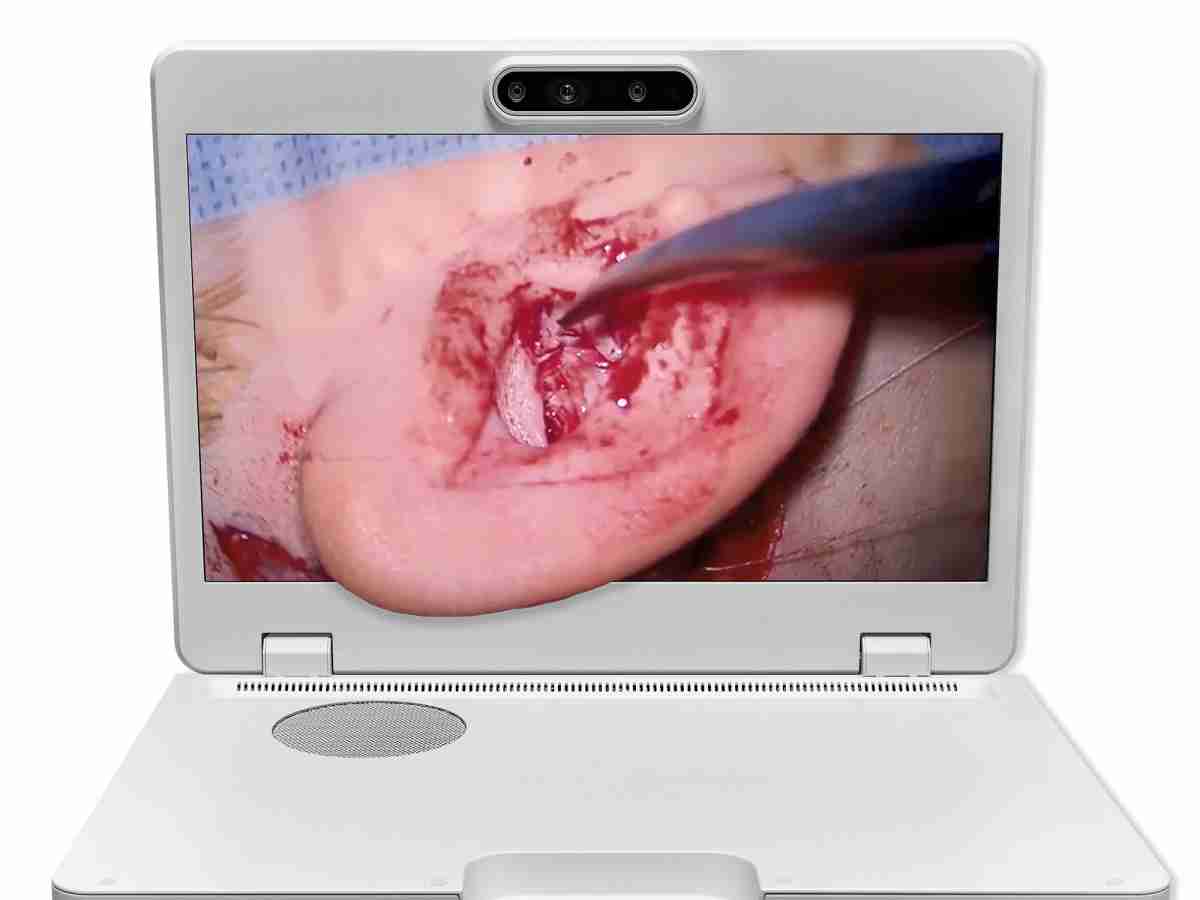 达擎之＂Heads-up 3D显微手术显示系统＂，，，，整合4K裸眼3D显示及眼球追踪系统，，，具备快速追踪人眼移动位置功能，，，，减轻医师长时间维持固定姿势的负担，，，让医师能有更宽广清晰的3D立体视野及更舒适的姿势来执行手术。。